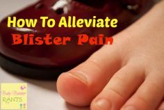 
                        
                            How To Alleviate Blister Pain
                        
                    