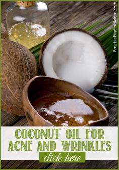 Coconut Oil for Acne and Wrinkles - Don't buy expensive creams, save money and incorporate coconut oil into your daily routine.