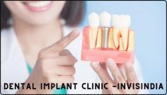 What is a dental implant?

Dental problems are very common for all the people around the world irrespective of the region you stay in. A person has to visit the dentist for regular checkups to avoid tooth loss, periodontal disease, decaying of the tooth, or infection. Follow this link https://www.invisindia.com/blog/what-is-a-dental-implant/