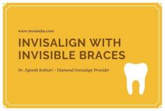 Invisalign with Invisible braces

Very few people on this planet have a perfect set of teeth and the rest of them are required to get it corrected with the help of braces. Earlier there was only an option of traditional braces but today with advanced dentistry, multiple options are available and the most opted one is Invisible Braces.