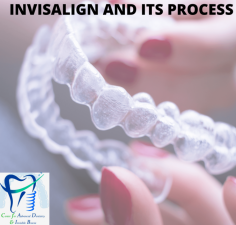 Invisalign and its Process

Many times we wonder why is the smile so important and the answer is “ A smile is the prettiest thing you can wear” and is rightly said as it has the power to solve all the problems.
