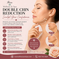 Enhance your profile and boost your confidence with double chin reduction treatments. This non-invasive procedure targets stubborn fat beneath the chin, helping to define the jawline and create a slimmer, more youthful appearance. Double chin reduction can improve facial contours, tighten the skin, and deliver natural-looking results without surgery or lengthy recovery times. Rose Wellness & Spa offers customized solutions to help you achieve your aesthetic goals.